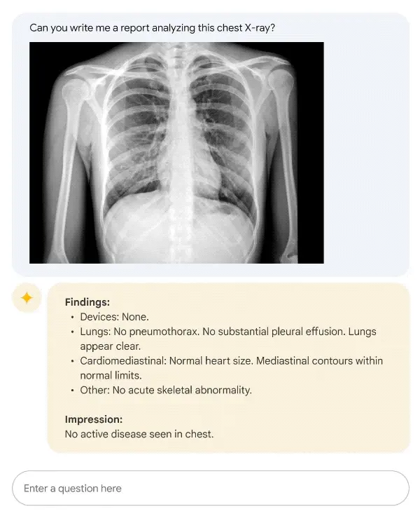An AI model fine-tuned for medical imaging analyzes a chest X-ray and generates a detailed report of its findings and impressions