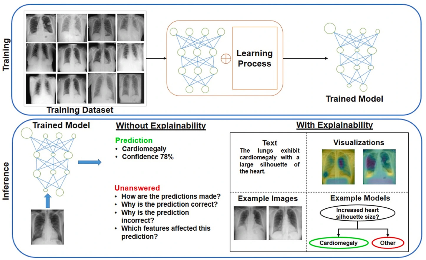 XAI in healthcare